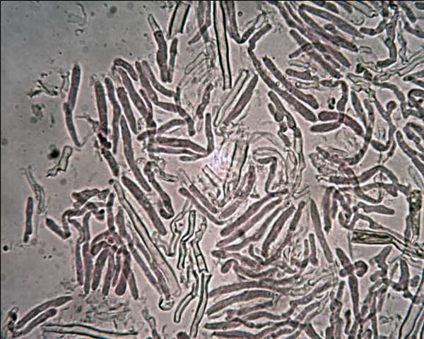 Stereum ochraceoflavum ? (Stereum rugosum)